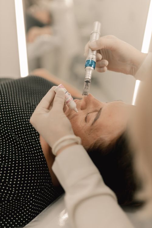 Skin renewal treatment at Umdlalo Wellness Spa — microneedling on the KZN South Coast